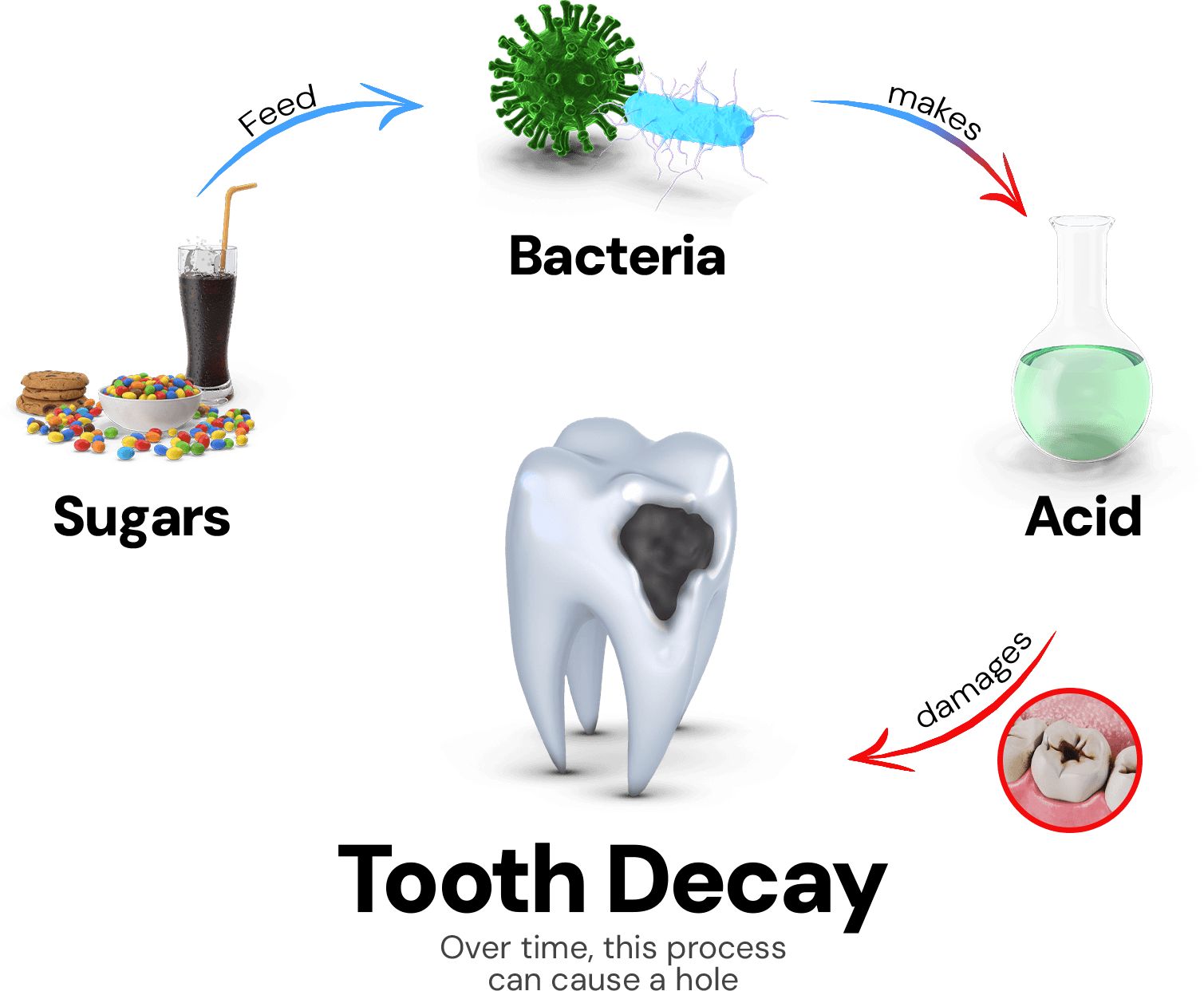 Cavities Diagram